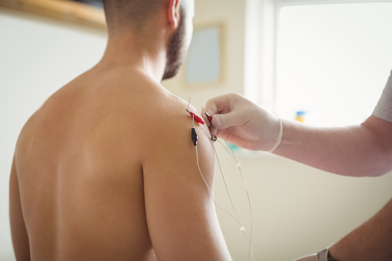 Acupunturista realiza procedimento de eletroacupuntura em paciente 